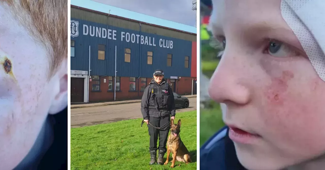 Police dogs to be used to detect pyrotechnics at Dundee FC game after fan injured