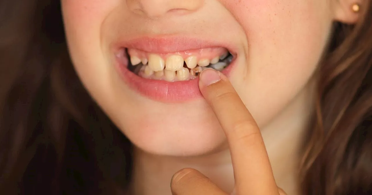 Galway Mother Urges Health Minister to Address Dental Care Issue