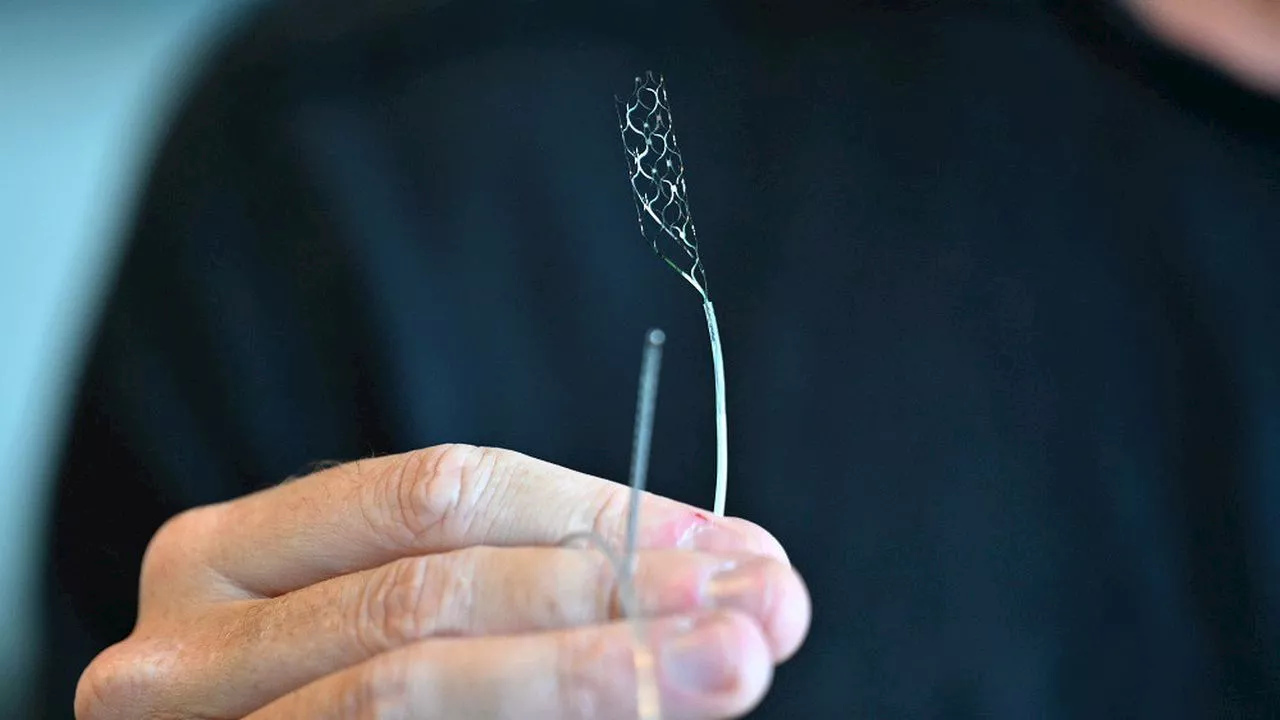 Implants cérébraux : Synchron, le rival de Neuralink, lance son premier test à grande échelle