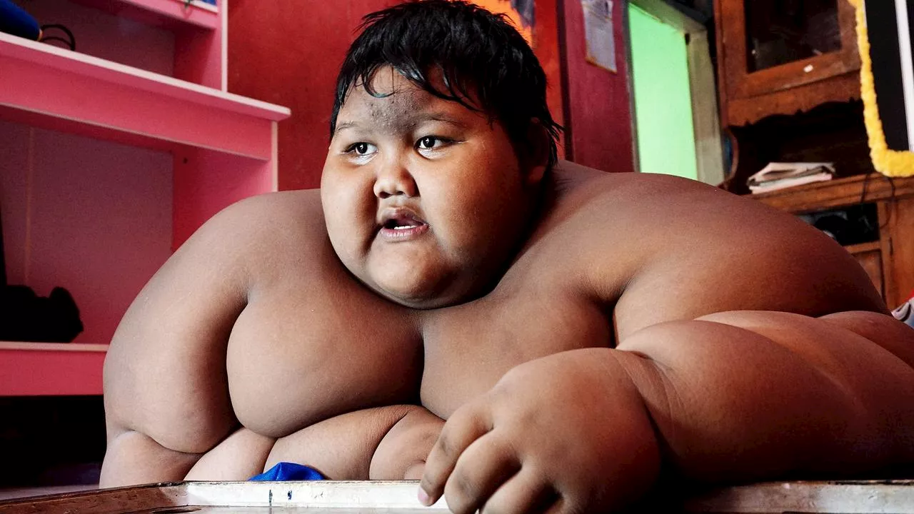 ‘World’s fattest boy’ is now unrecognisable