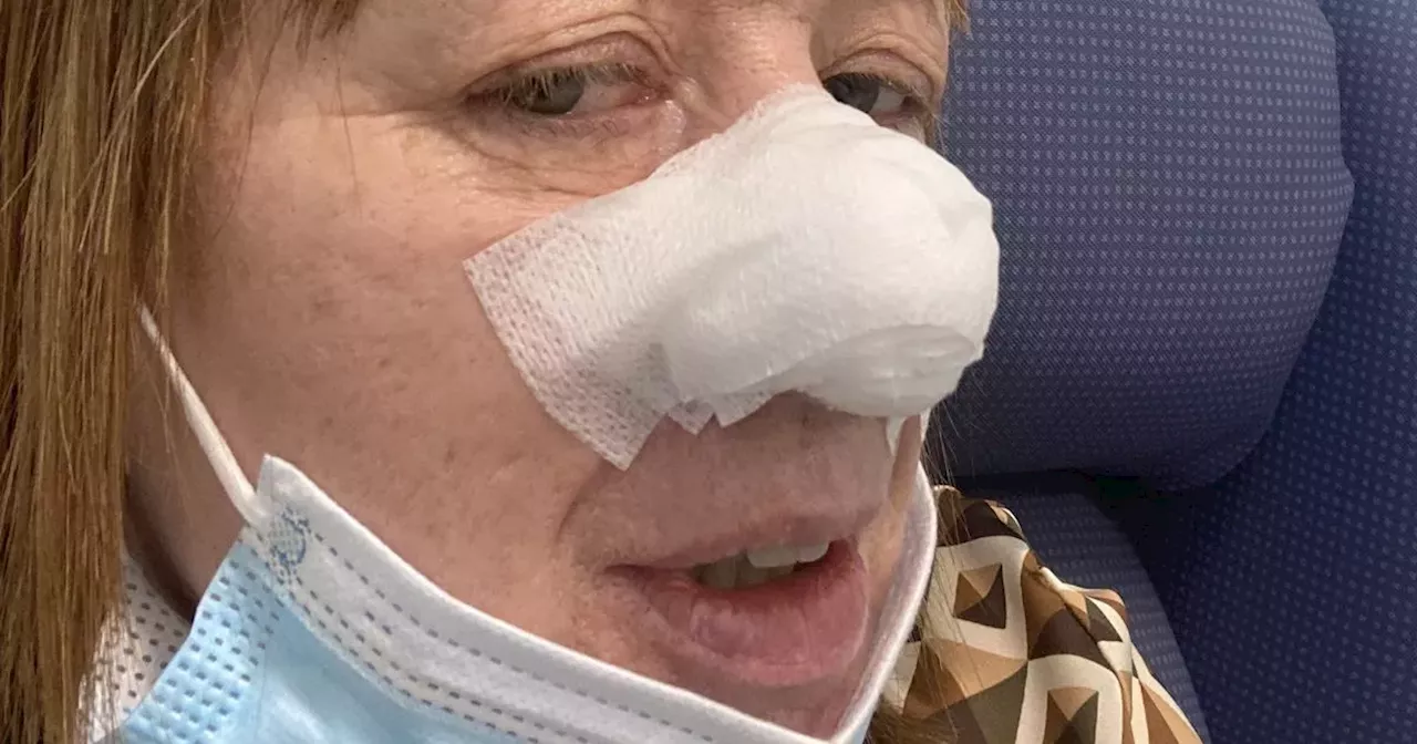 Dentist diagnoses mum's skin cancer that doctors missed