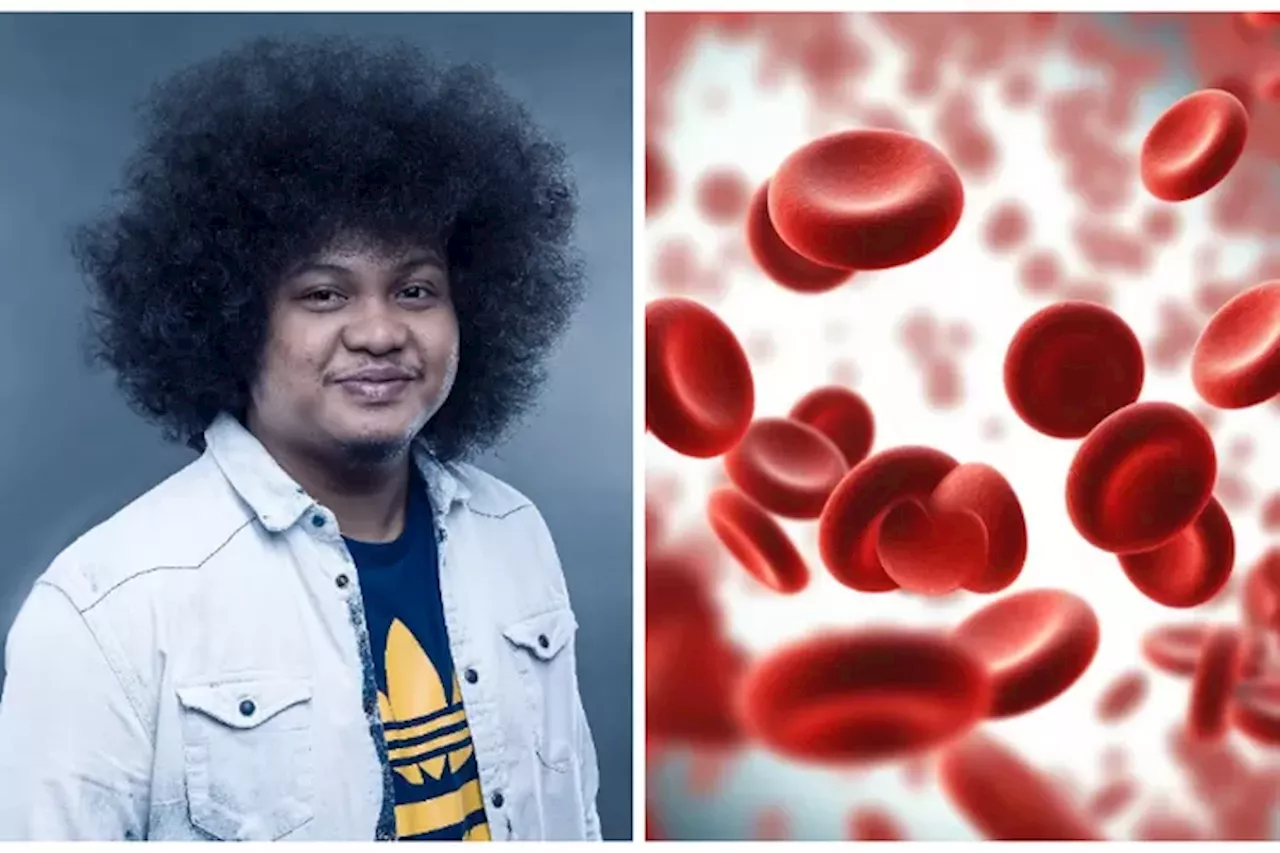 Mengenal Anemia Aplastik, Penyakit Langka yang Diderita Babe Cabita sebelum Meninggal Dunia