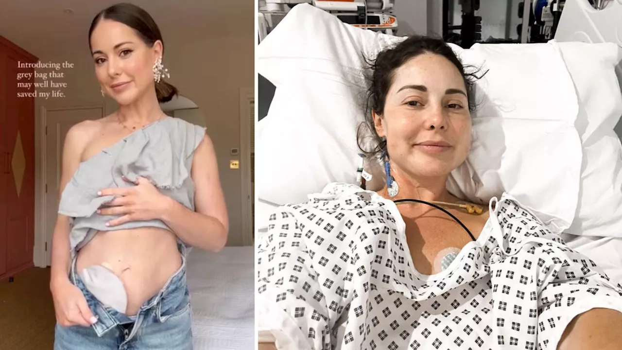 Former Made in Chelsea star Louise Thompson reveals she had 'life-saving' stoma bag fitted