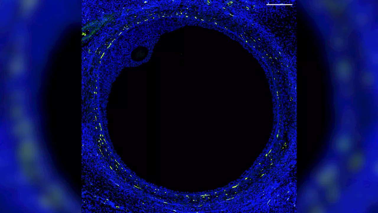 1st 'atlas' of human ovaries could lead to fertility breakthrough, scientists say