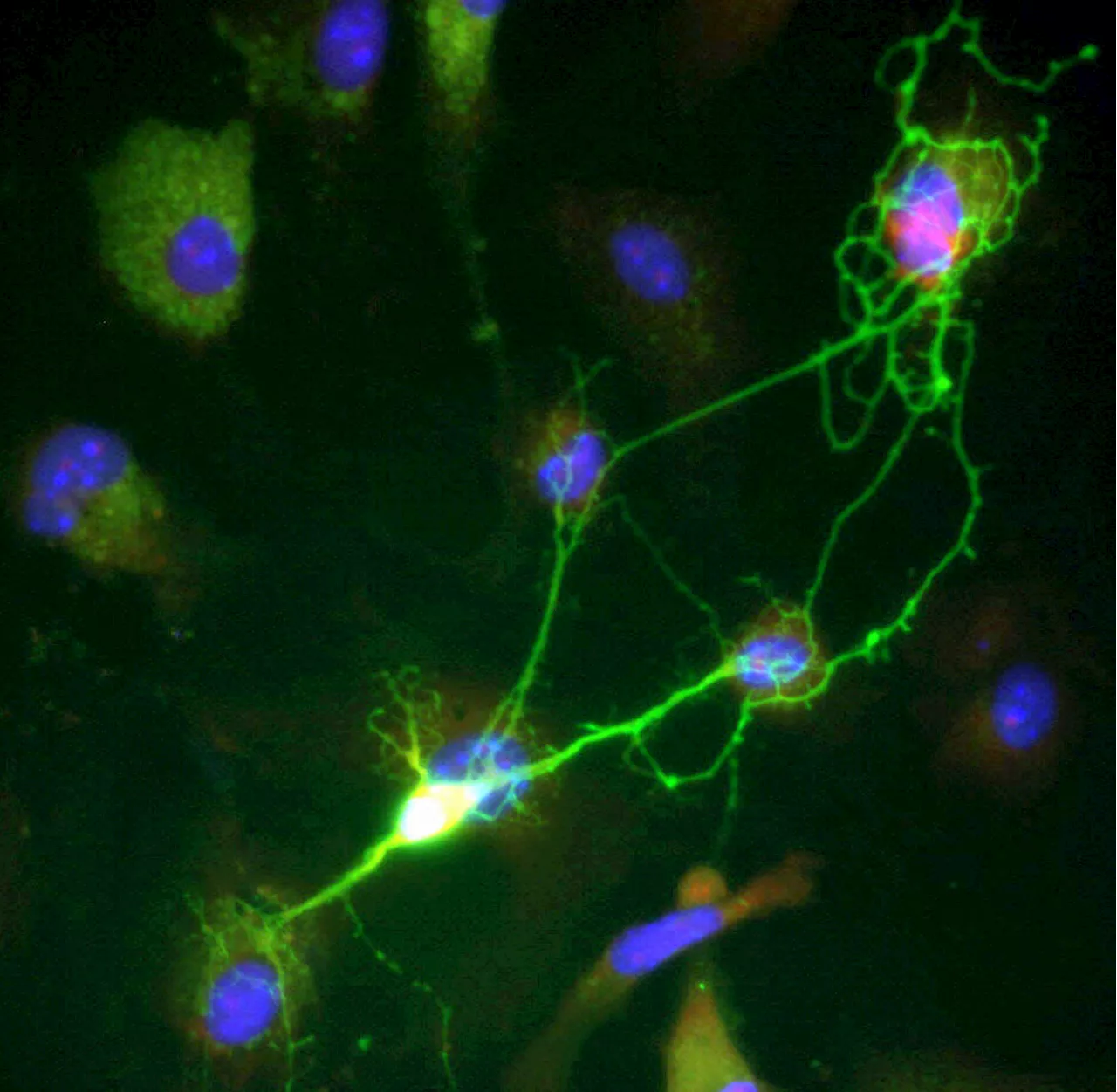 Morphine tolerance found to result from Tiam1-mediated maladaptive plasticity in spinal neurons