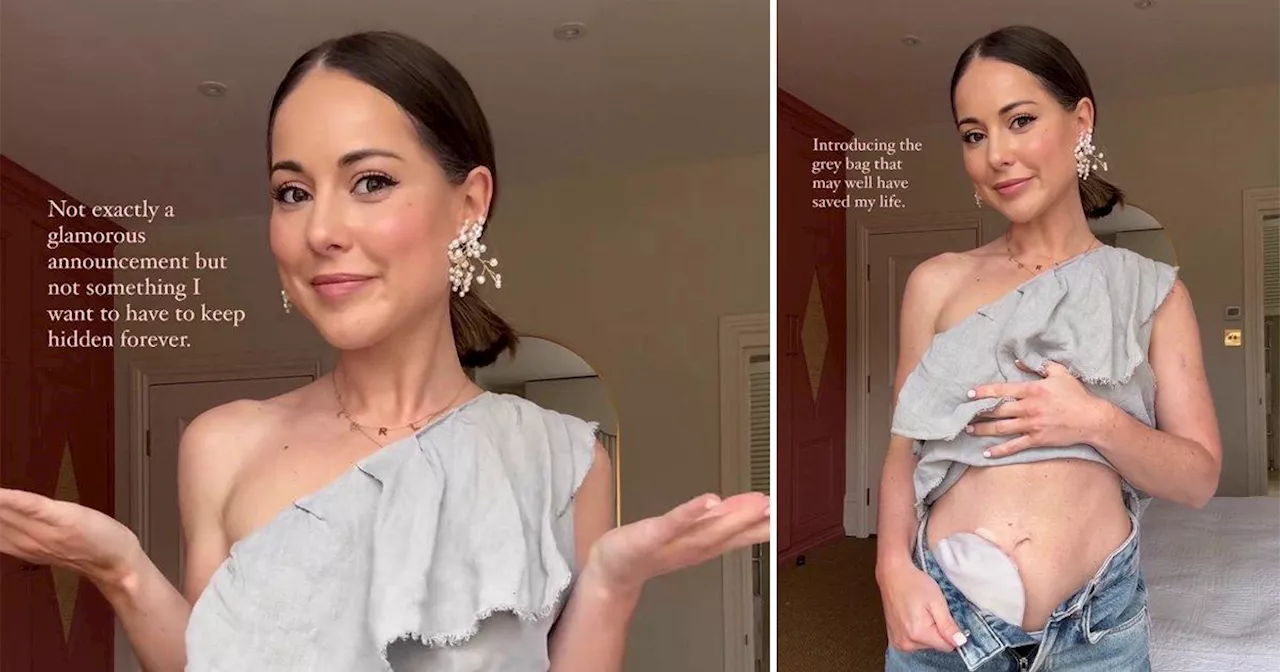 Made In Chelsea’s Louise Thompson reveals stoma bag for the first time