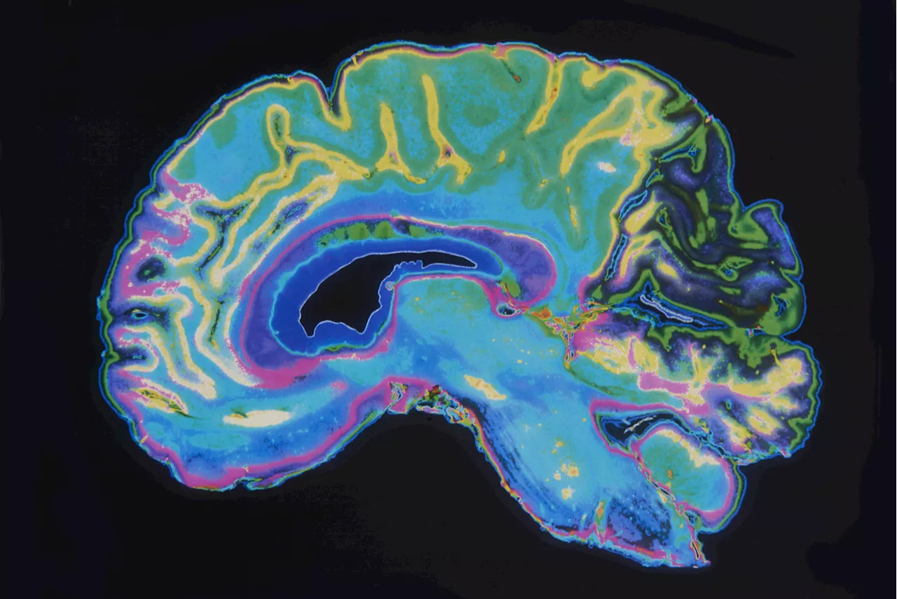 How Your Personality Type May Put You at Risk of Depression