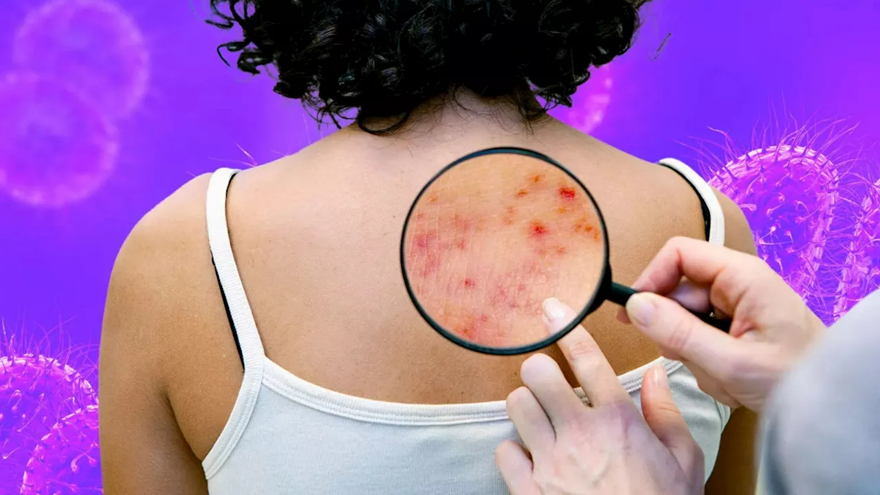 Changes in Your Skin Could Indicate a Life-Threatening Condition, Warns Pharmacist