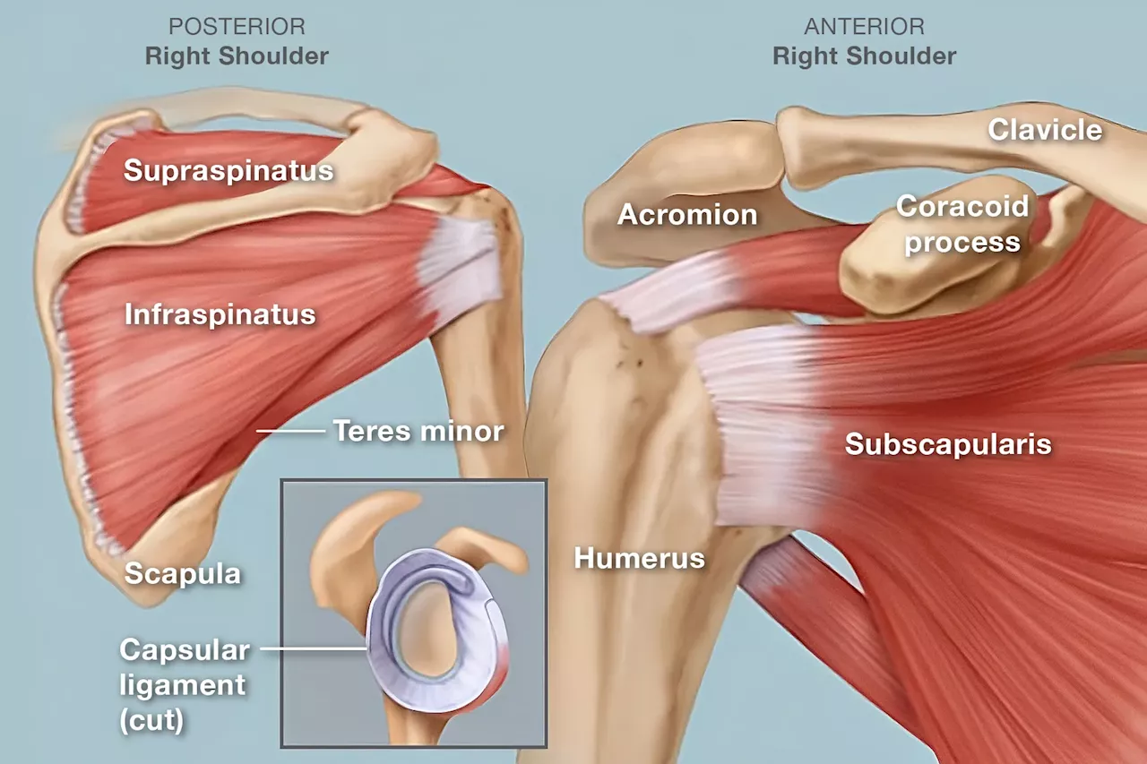 Shoulder Pain