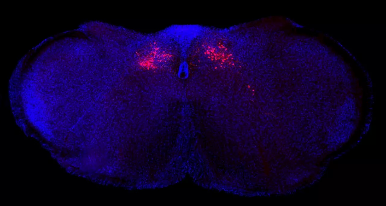 Scientists identify new brain circuit in mice that controls body's inflammatory reactions