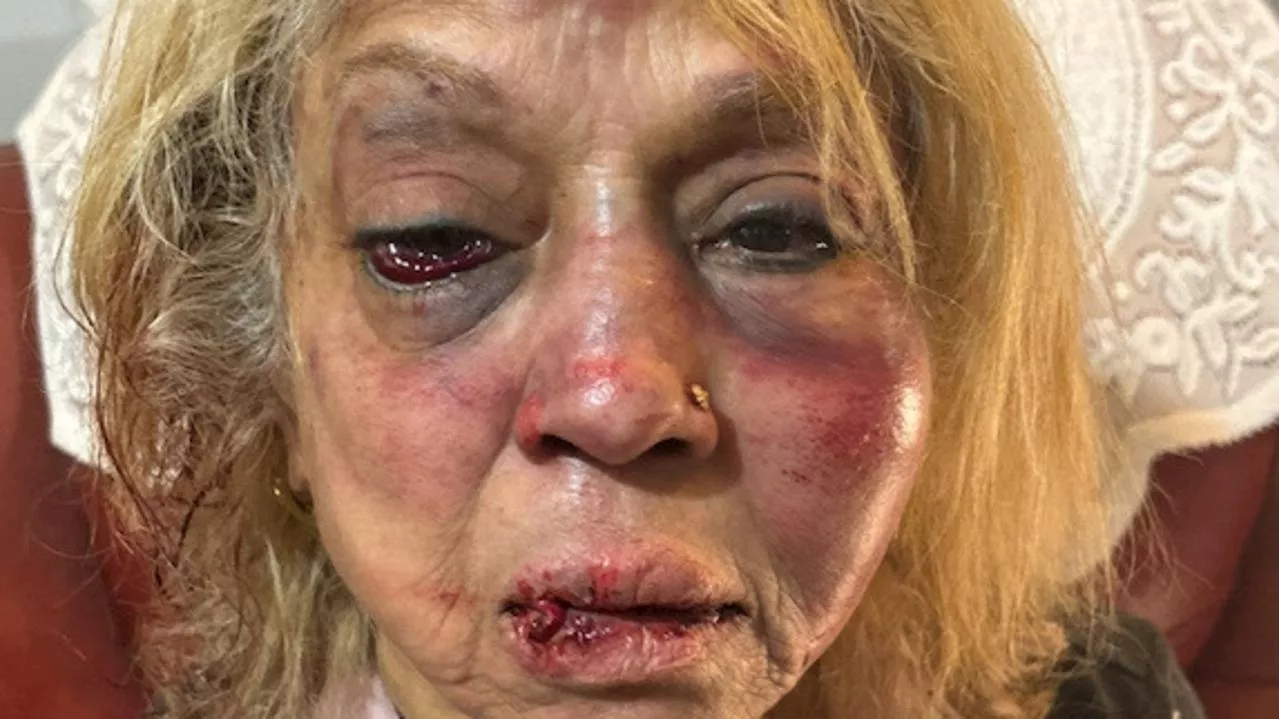 ‘Don’t feel safe’: Bashed grandma ‘let down’