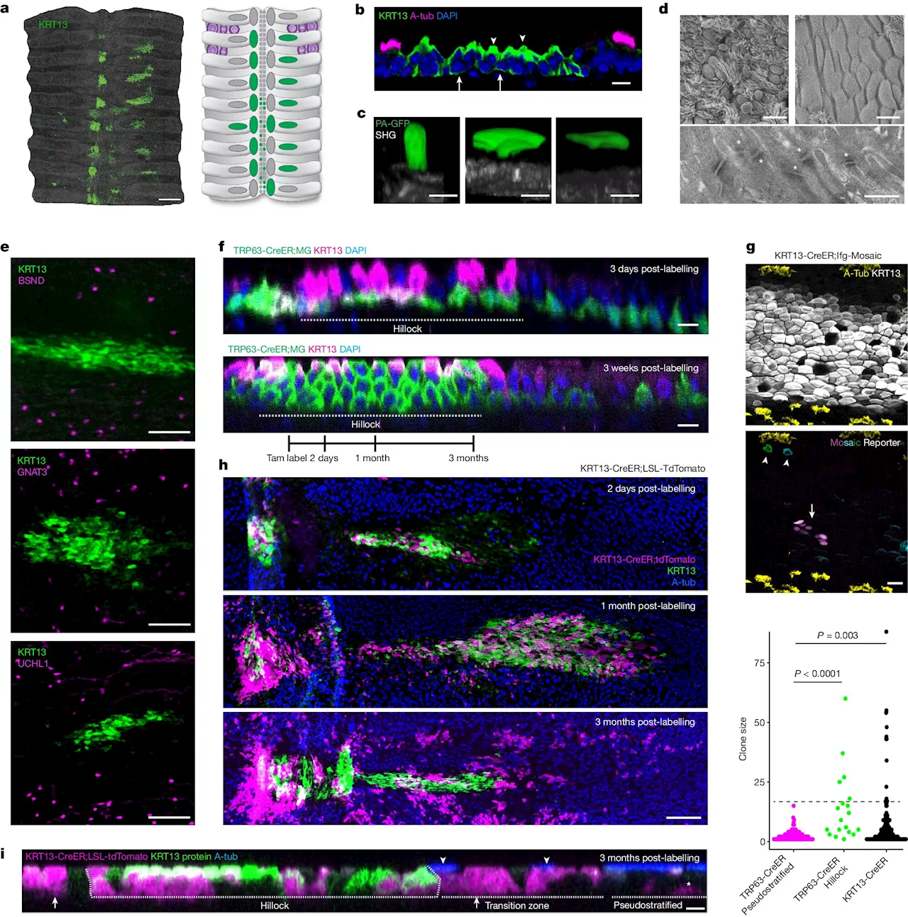 Study: Airway hillocks challenge our understanding of lung biology