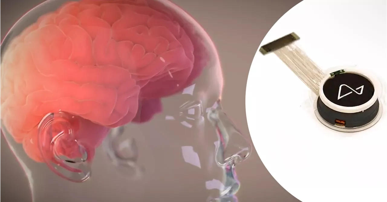 Neuralink's first brain chip implant developed a problem — but there was a workaround
