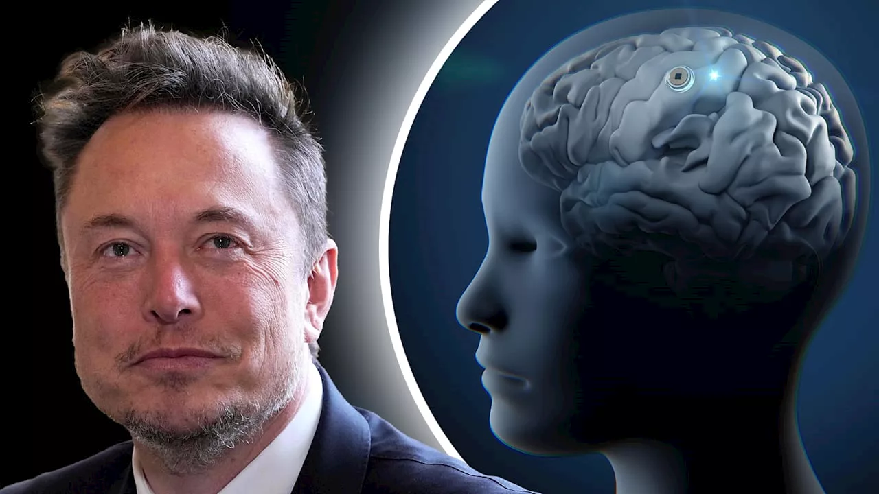 Chip soll Gedanken lesen: Probleme bei Elon Musks Gehirn-Implantat