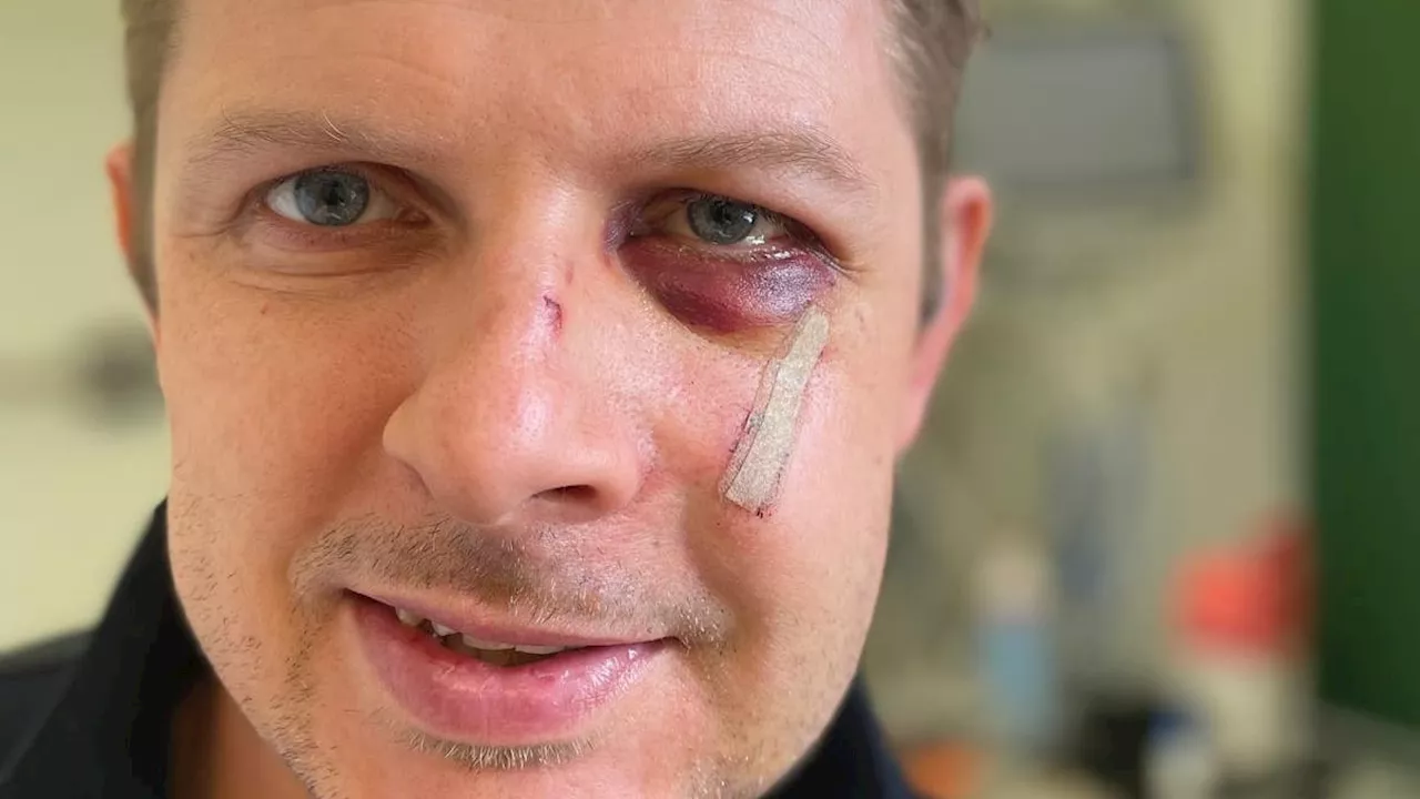 SPD-Politiker Ecke über Prügel-Attacke: „Angriff war eine Sache von wenigen Sekunden“