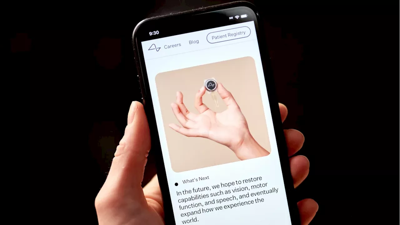 El primer implante cerebral de Neuralink en humanos sufrió un problema, pero se solucionó