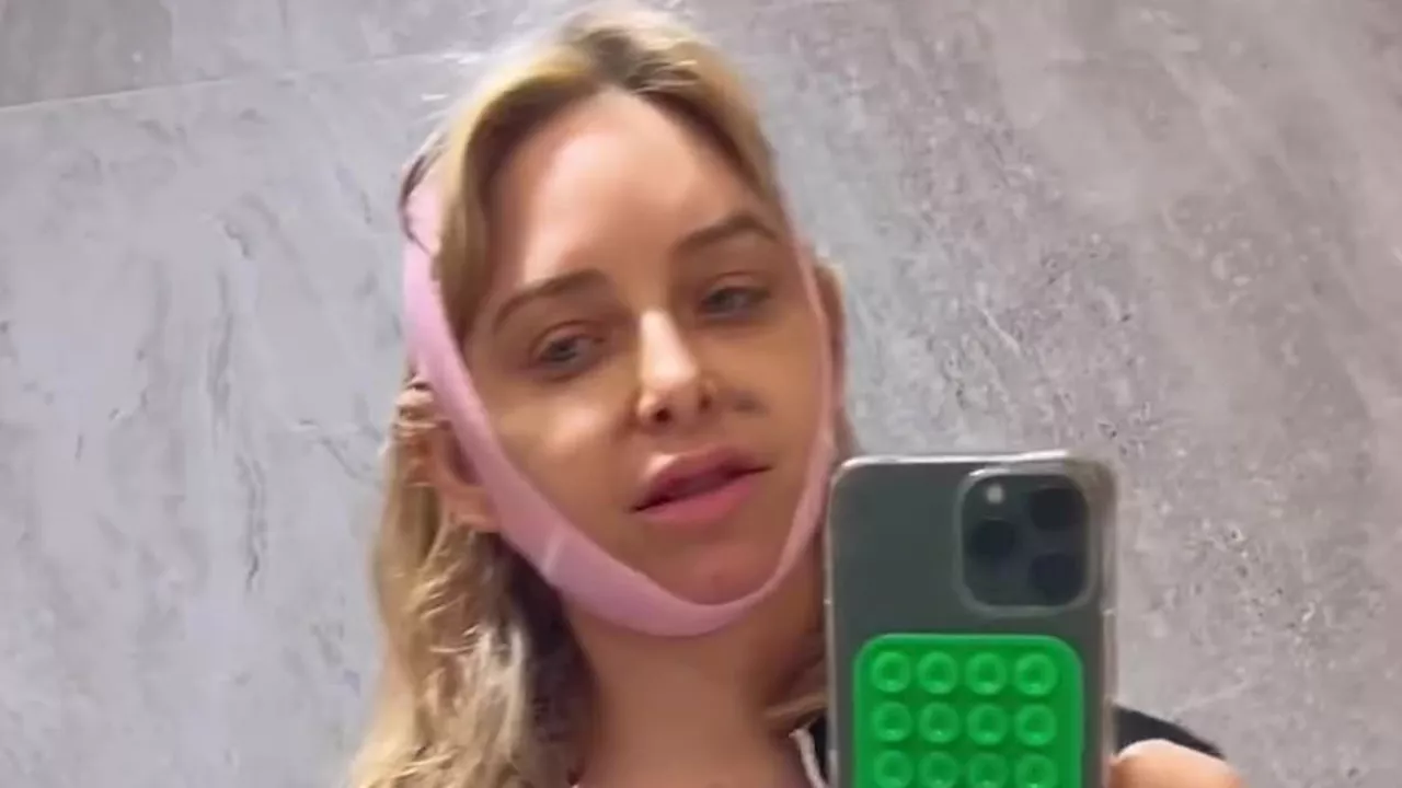 Jenny Mollen, 44, gets 'breast lift, fat transfer, and chin lipo'