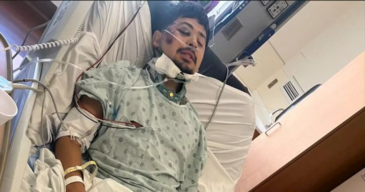 Denver man speaks out after suffering serious injuries in scooter hit-and-run