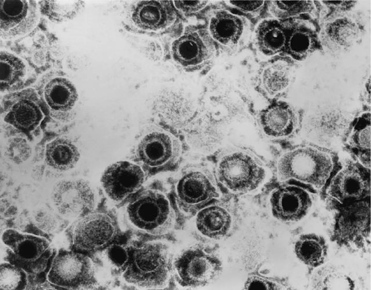 How herpes hijacks a ride into cells