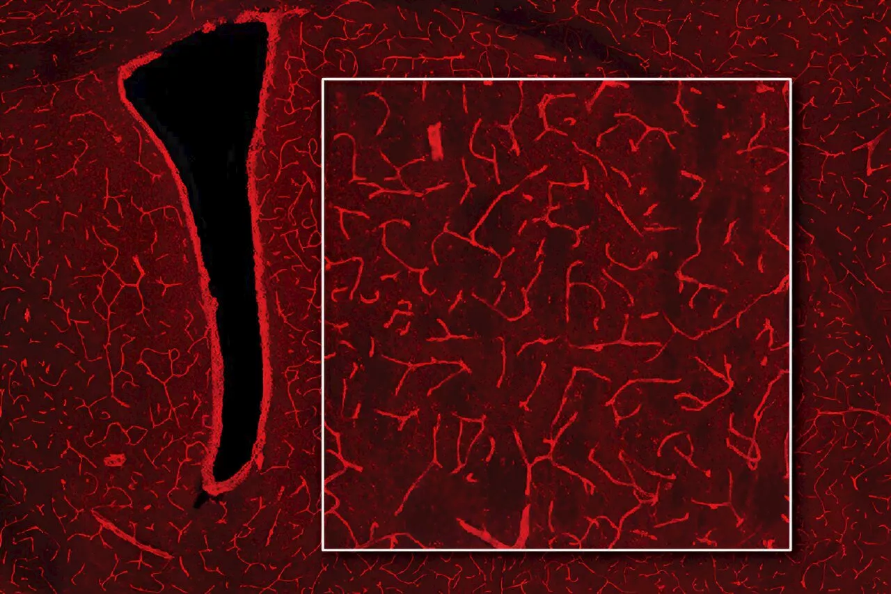 Using MRI, engineers have found a way to detect light deep in the brain