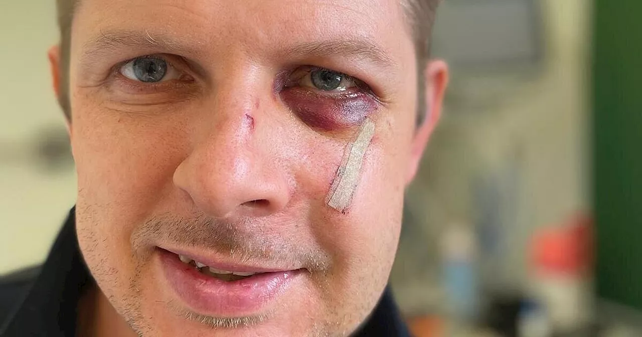 Nach Attacke auf ihn: Das sagt Politiker Matthias Ecke über den Angriff
