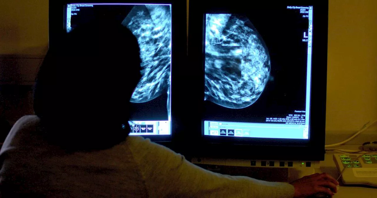 HSE approves new treatment option for people with breast cancer at high-risk of recurrence