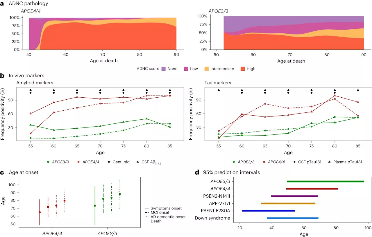 Study suggests two copies of APOE4 gene behind up to 20% of Alzheimer's cases