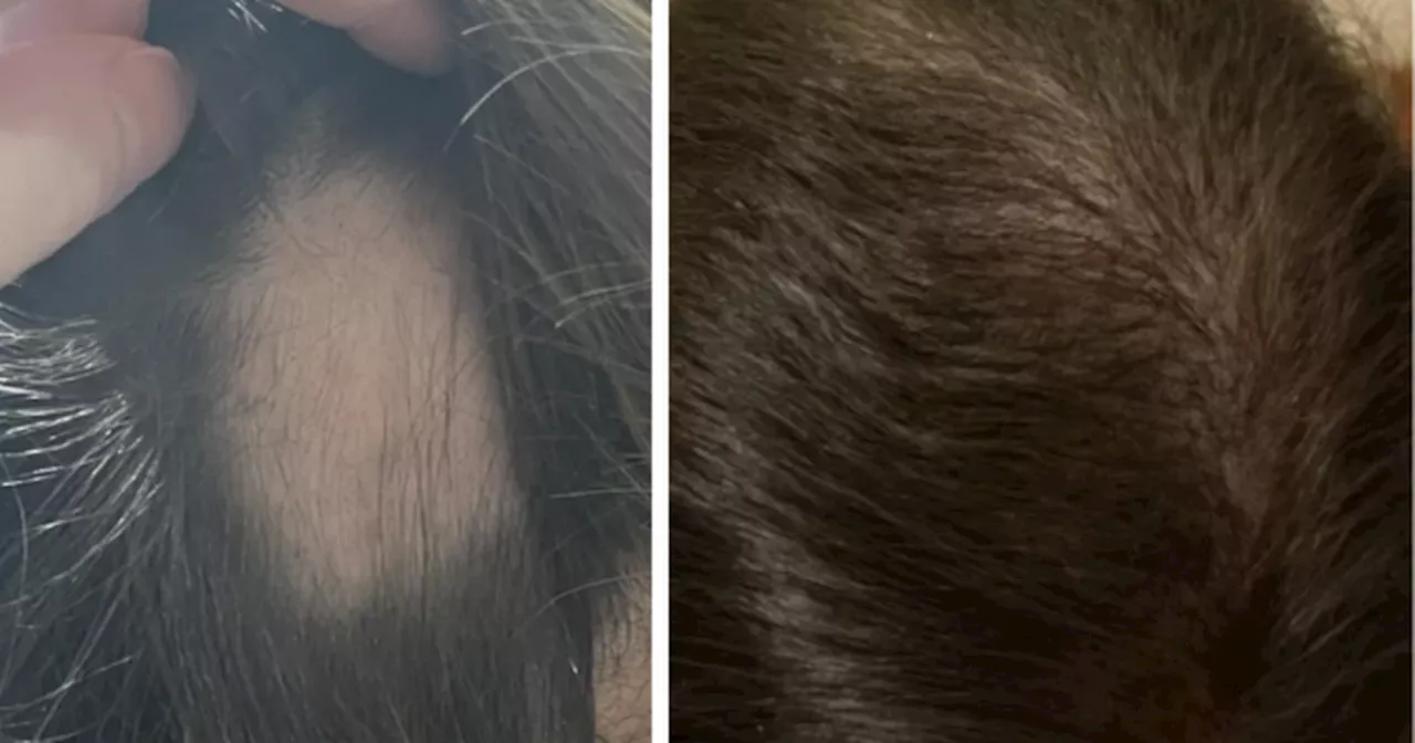 Beauty buffs insist 'miracle' £15 hair growth solution 'really works'