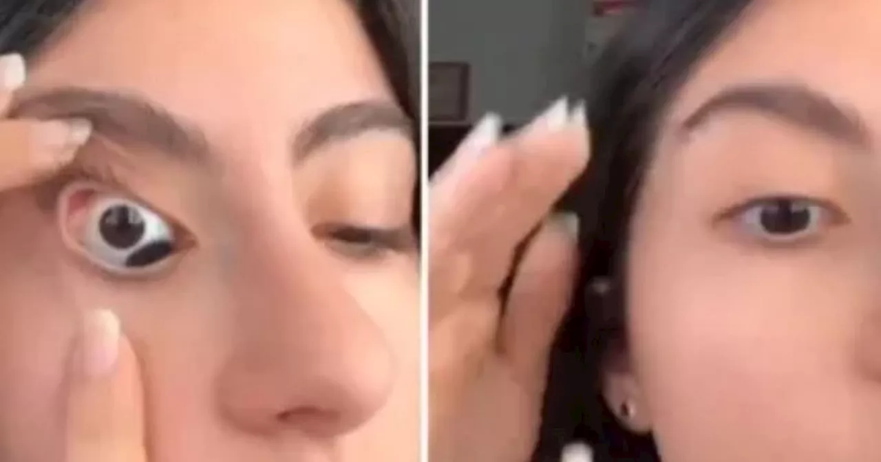 Impactante: mujer muestra en video sus “tres ojos”