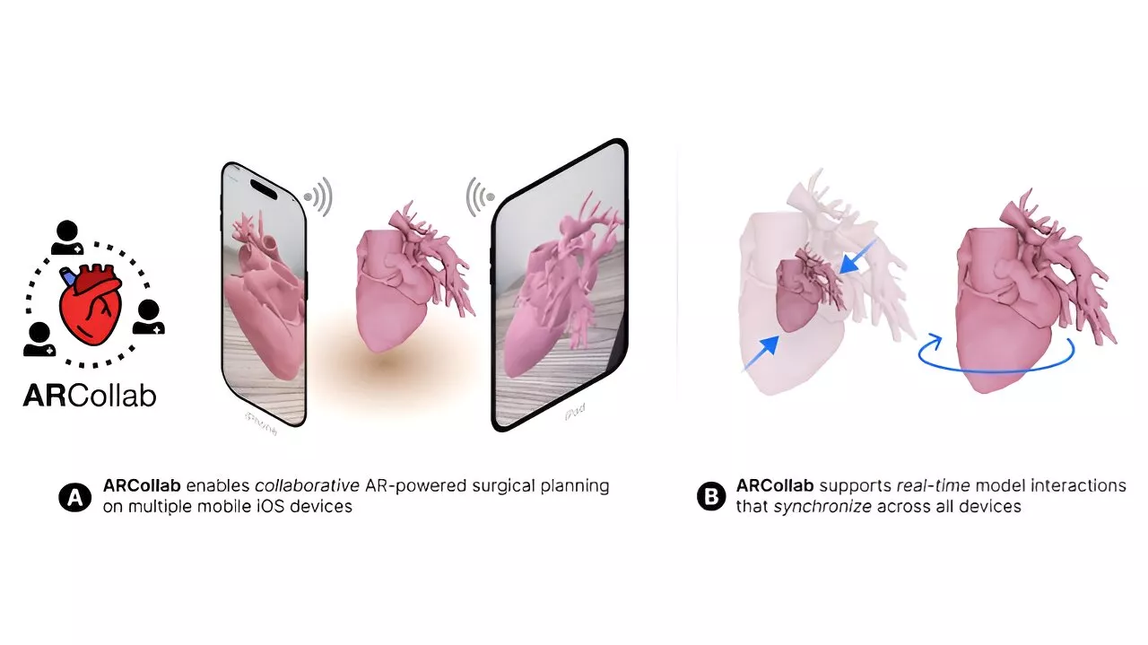 Researchers partner with children's hospital on new heart surgery planning tool