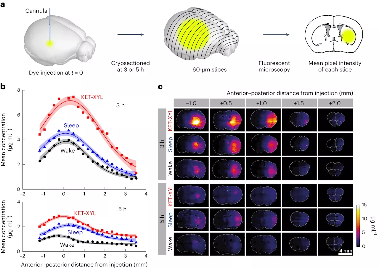 Scientists find sleep may not clear brain toxins