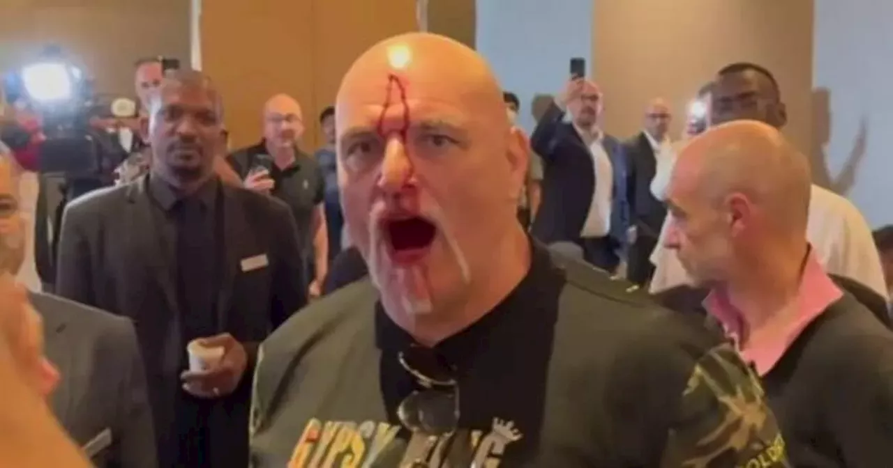 John Fury left bloodied after scuffle before son Tyson's fight with Usyk