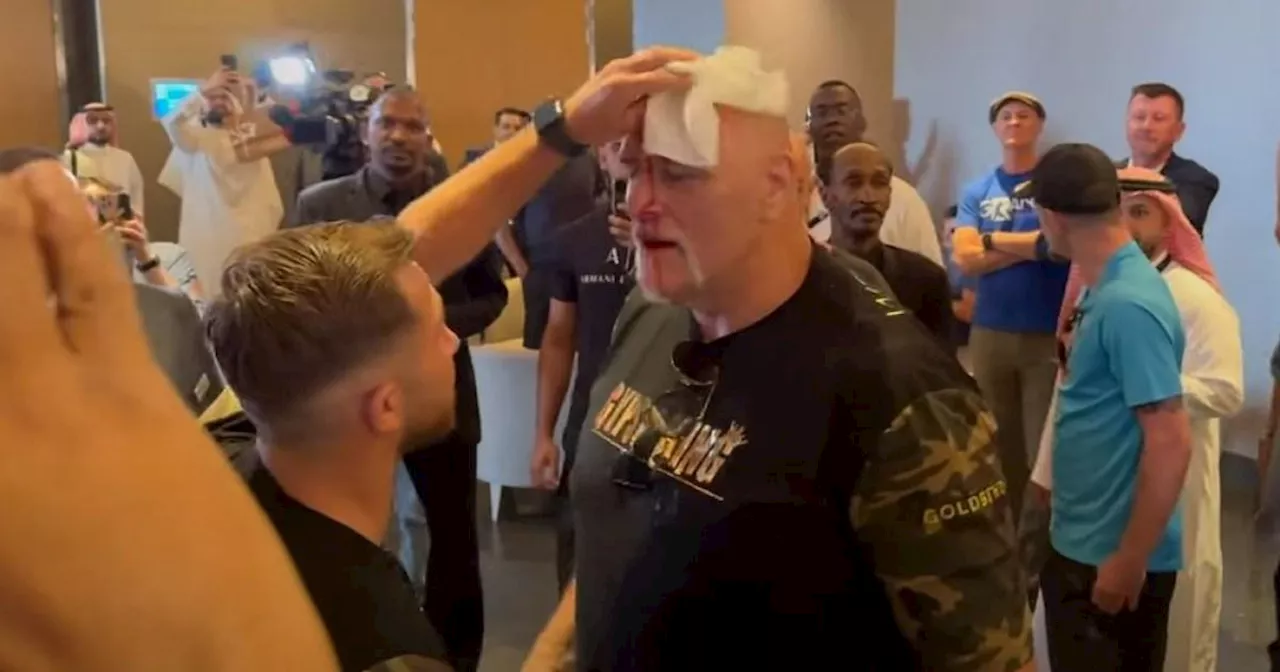 Tyson Fury's dad, John Fury, bloodied after headbutting Oleksandr Usyk team member