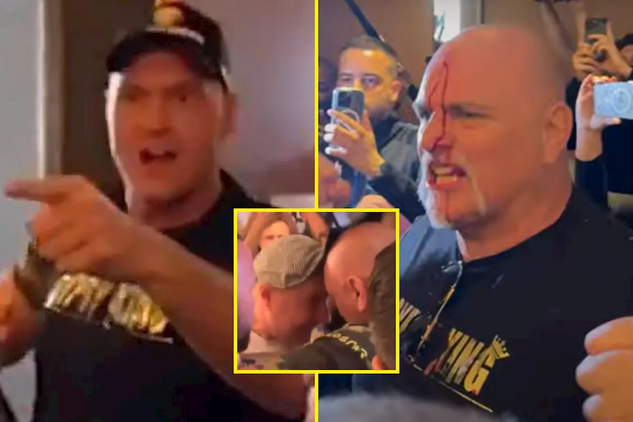 Tyson Fury has priceless reaction to John Fury’s blood-soaked face after headbutting member of Oleksandr U...