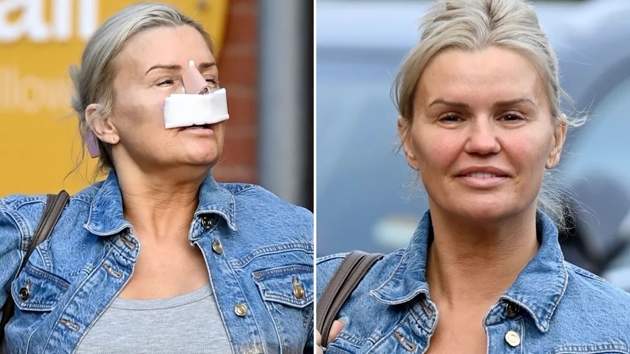 Kerry Katona reveals plans for FACELIFT – despite ‘agony’ after removing rib to make new nose...