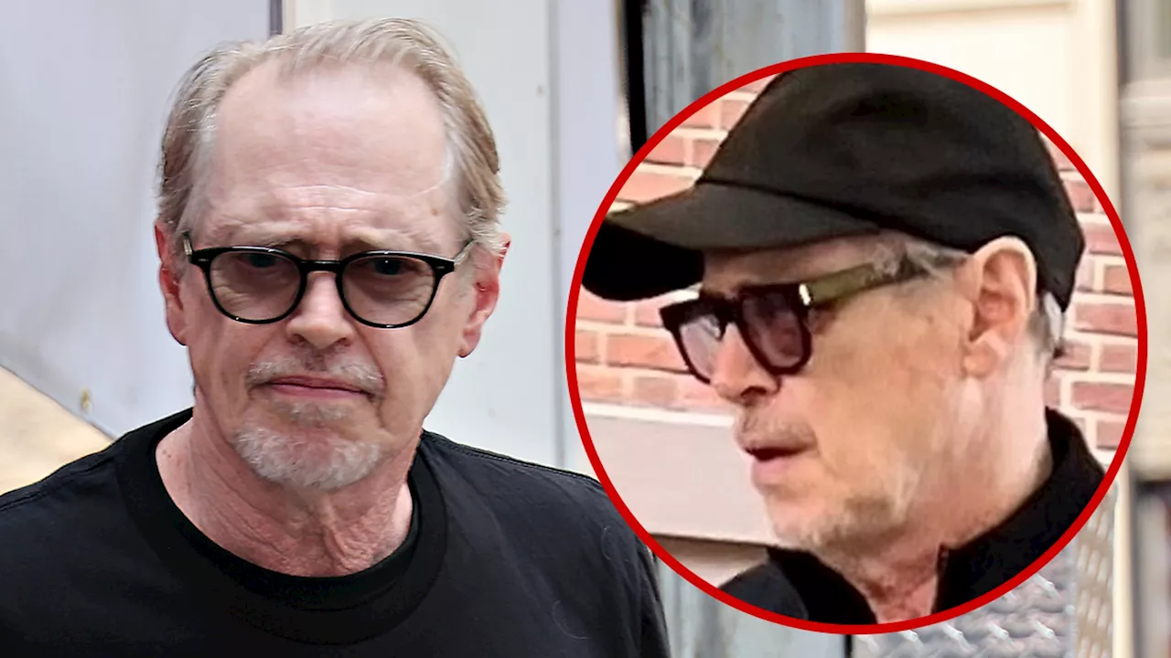Steve Buscemi Has Black Eye After Random Attack in NYC