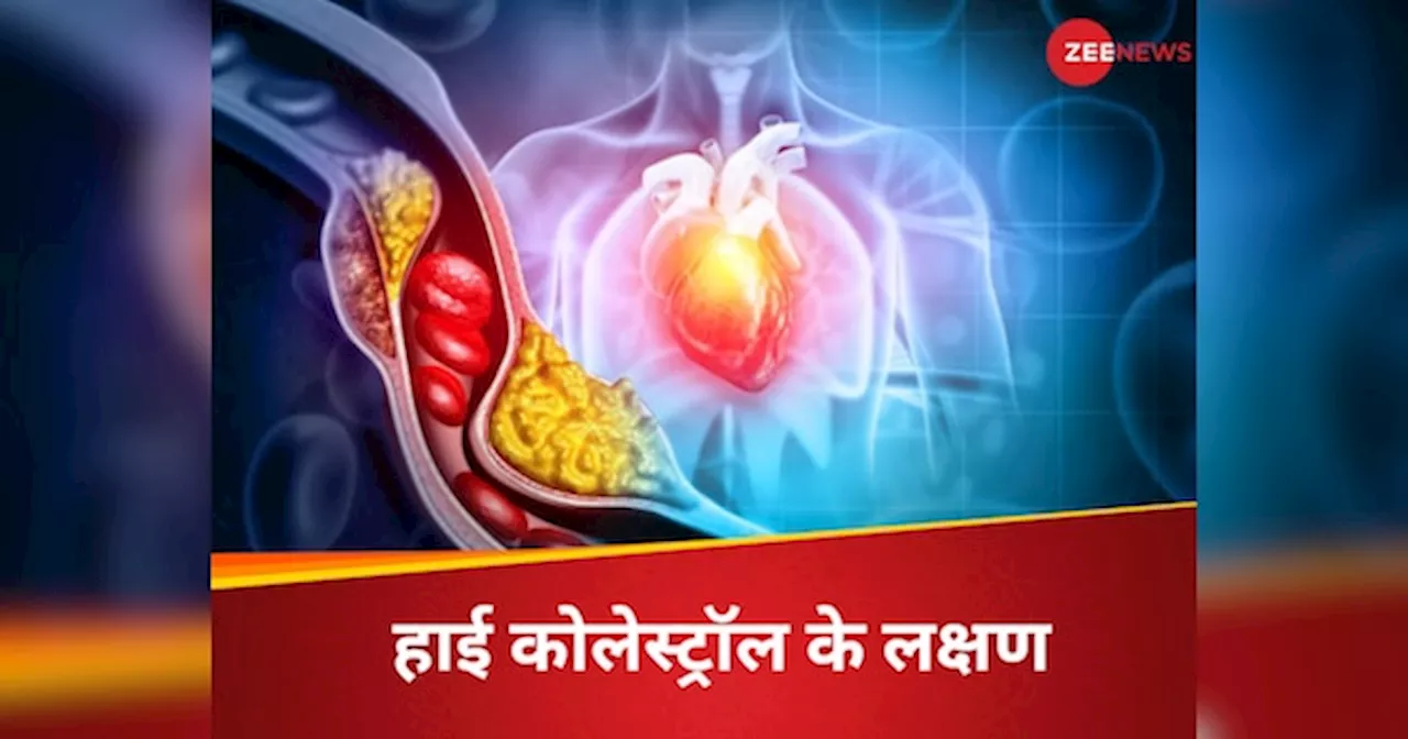 LDL Cholesterol: रात के समय बॉडी में नजर आते हैं बैड कोलेस्ट्रॉल के ये 5 लक्षण, आप तो नहीं कर रहे नजरअंदाज