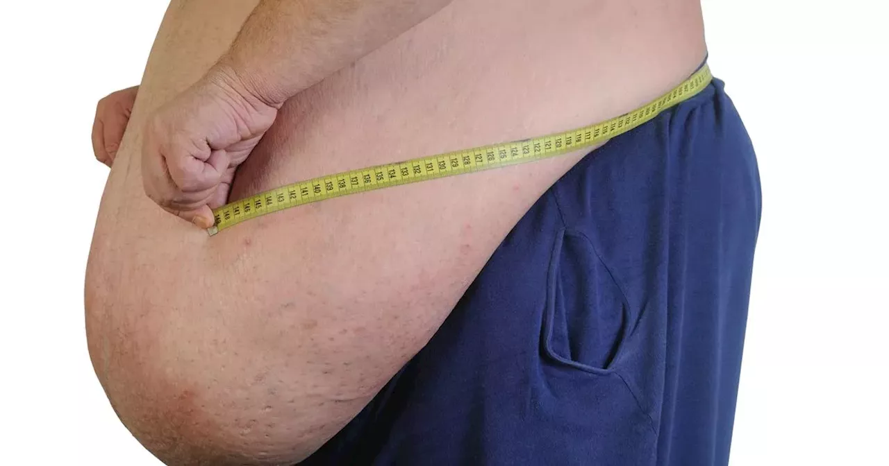 Number undergoing surgery for morbid obesity doubles at cost of €3.5 million