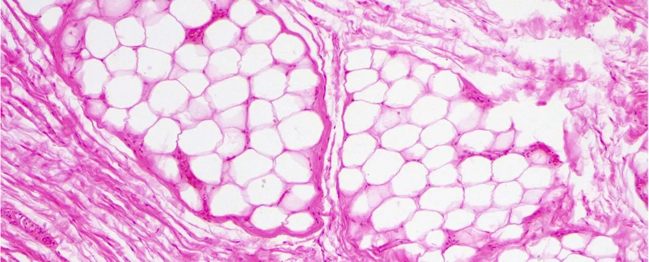 Mouse Experiment Uncovers a Crucial Switch That Breaks Down Fat For Warmth