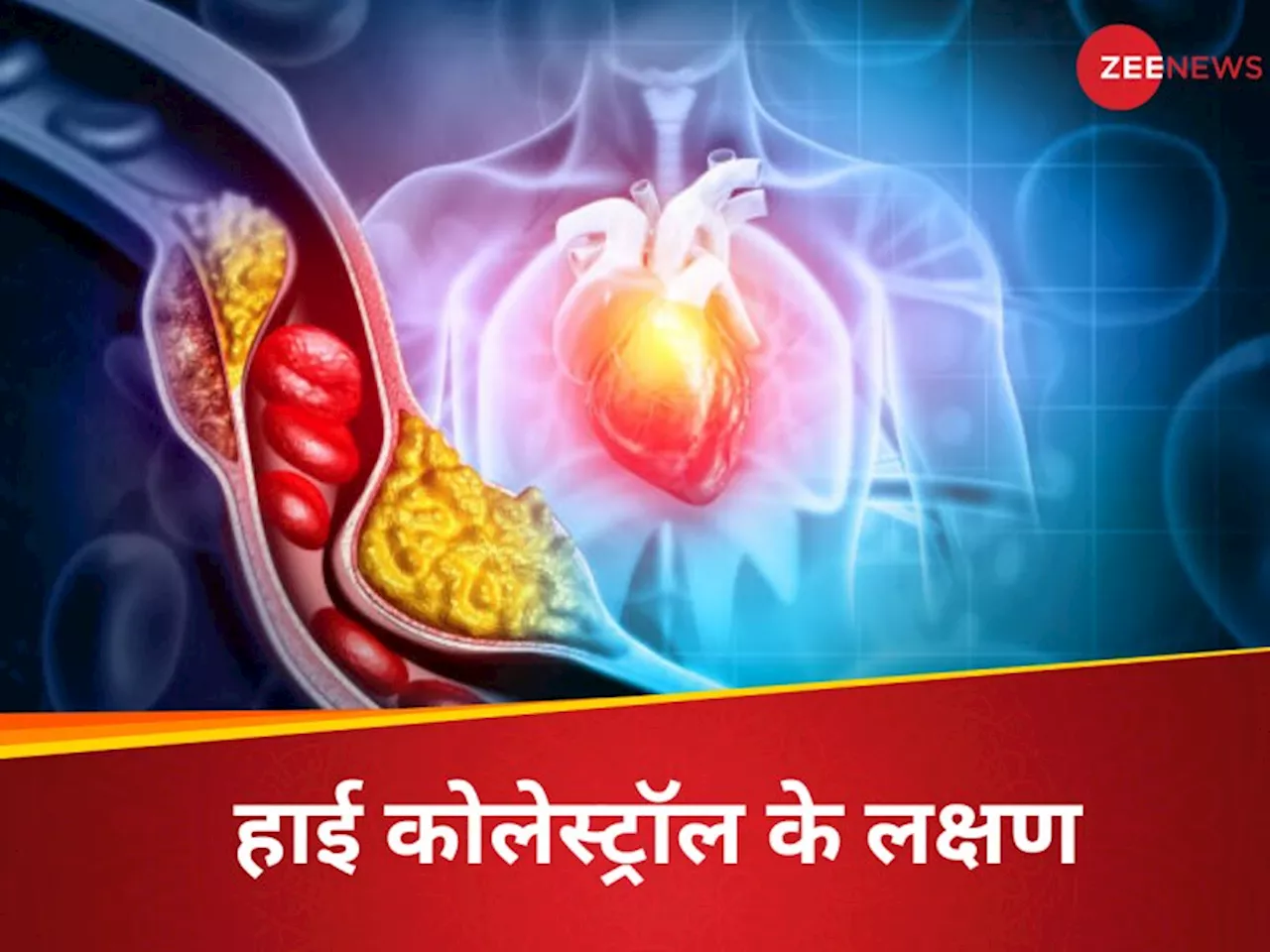 LDL Cholesterol: રાતના સમયે બોડીમાં જોવા મળે છે બેડ કોલેસ્ટ્રોલના 5 લક્ષણો, નજર અંદાજ કર્યા તો મર્યા