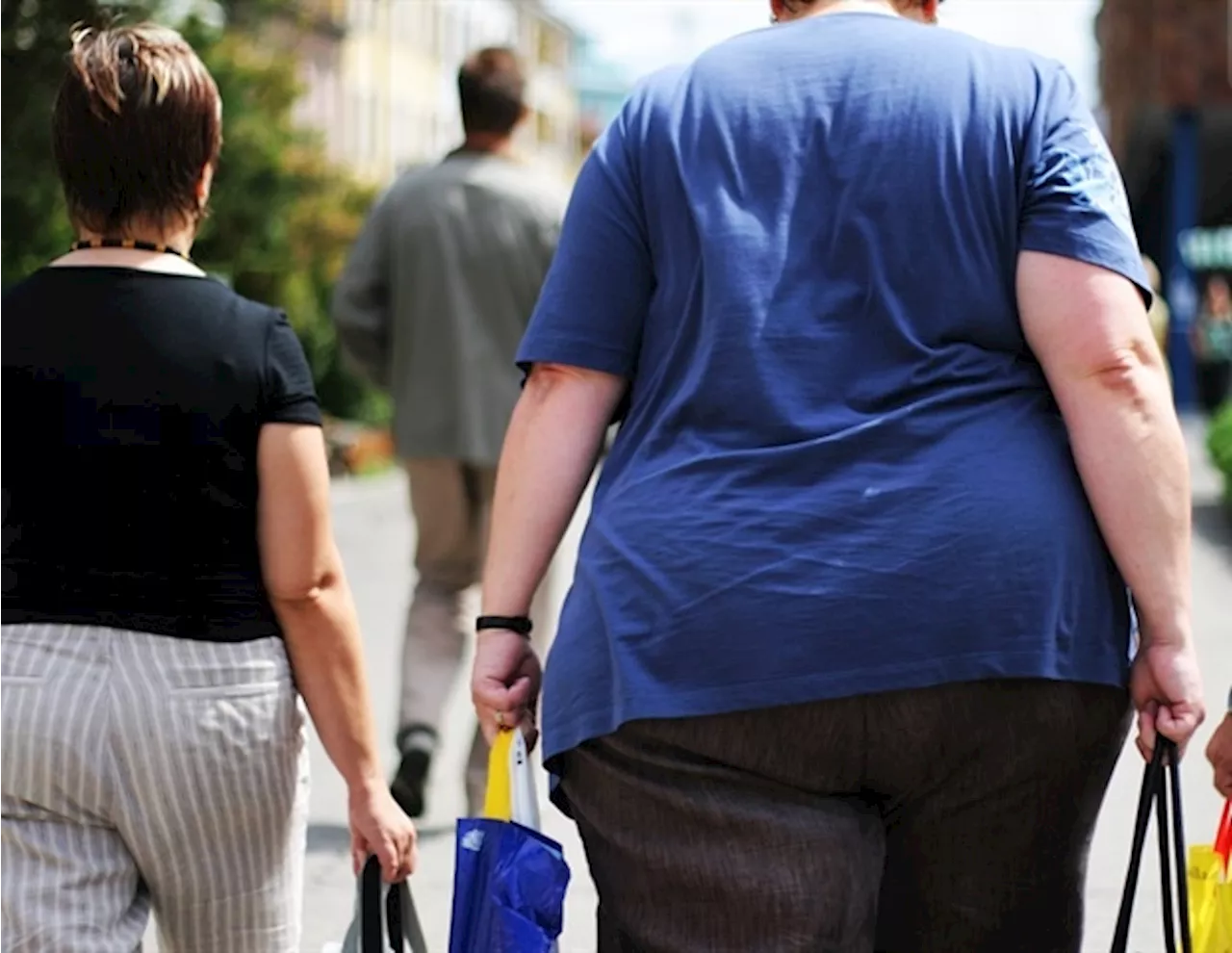 Technology alone insufficient for meaningful weight loss in obesity, study shows