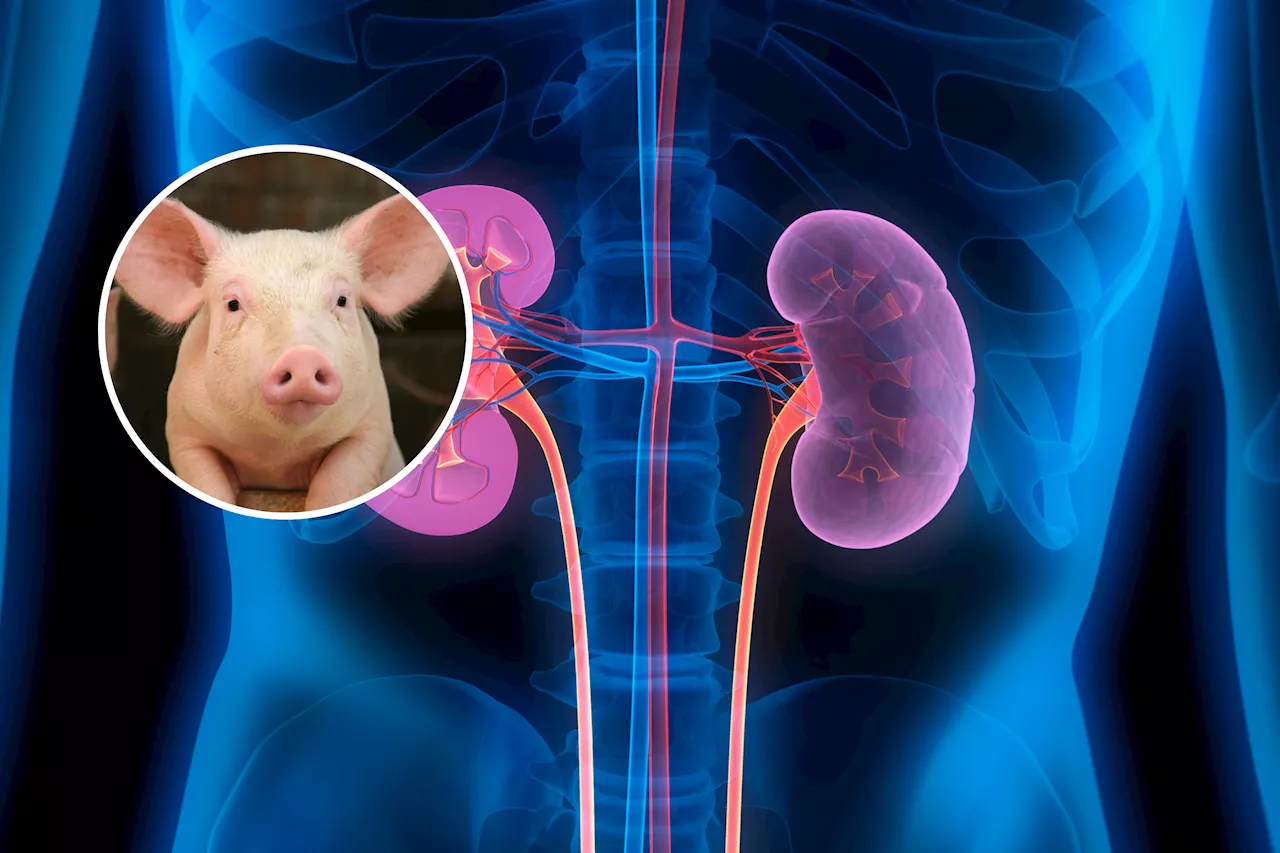 Pig-to-Human Transplants Condemned as 'Cruel and Dangerous' After Death