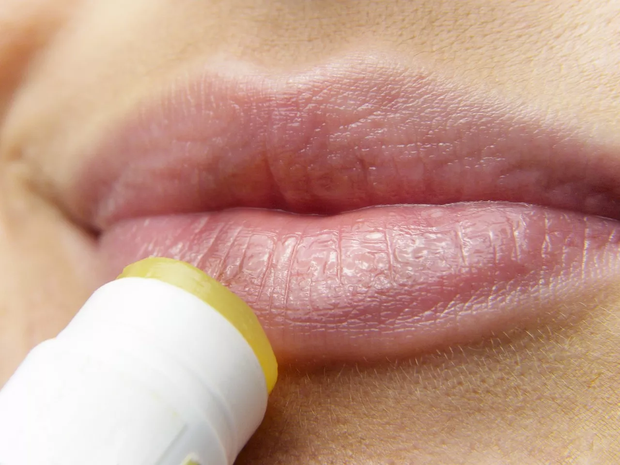 How To Get Rid Of Dark Lips – Home Remedies And Treatments