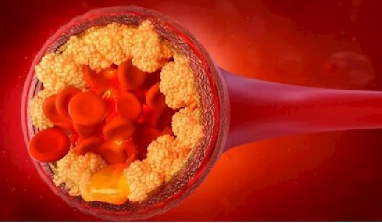 Cholesterol Control Tips: కొలెస్ట్రాల్‌ను సమూలంగా నిర్మూలించే అద్భుతమైన జ్యూస్