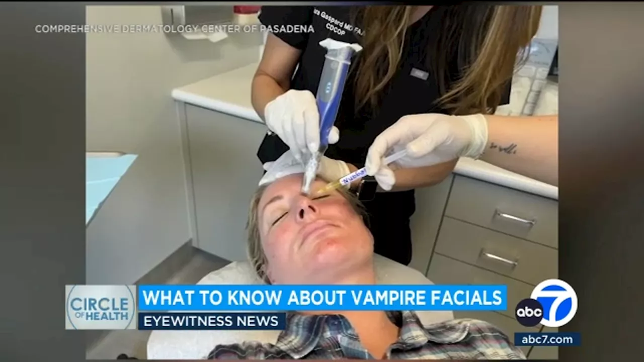 'Vampire facials' growing in popularity, but how do you know if they're safe? Doctors weigh in