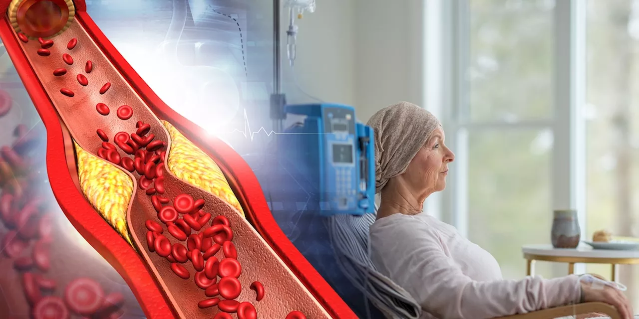 Krebsähnliche Zellen bei Arteriosklerose – das macht Hoffnung für Erkrankte