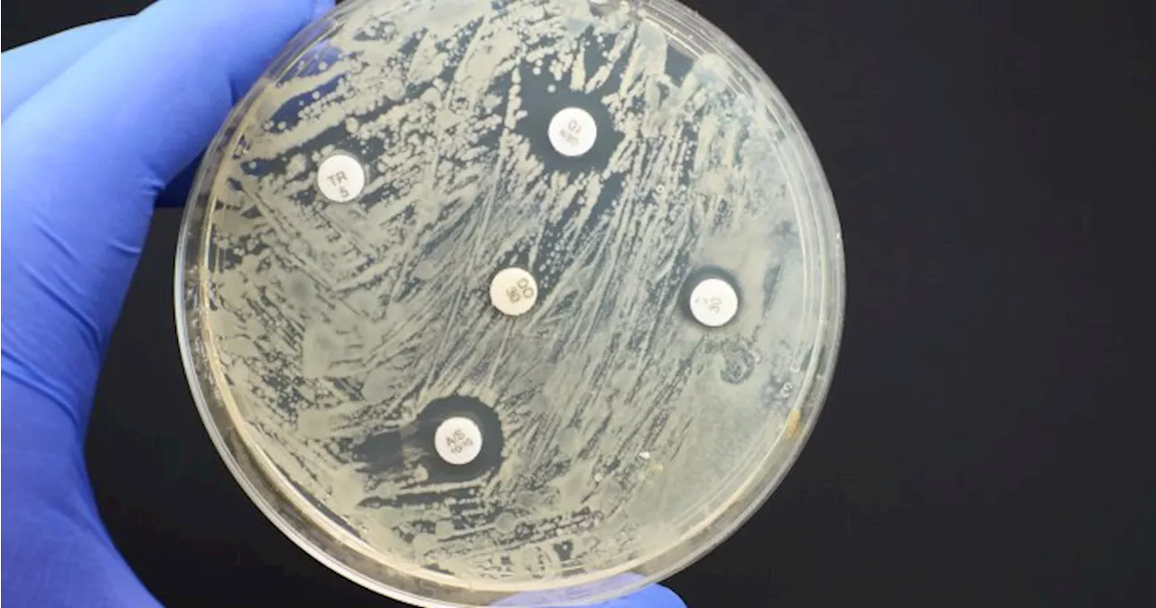 Canada introduces new guidelines to tackle antimicrobial resistance