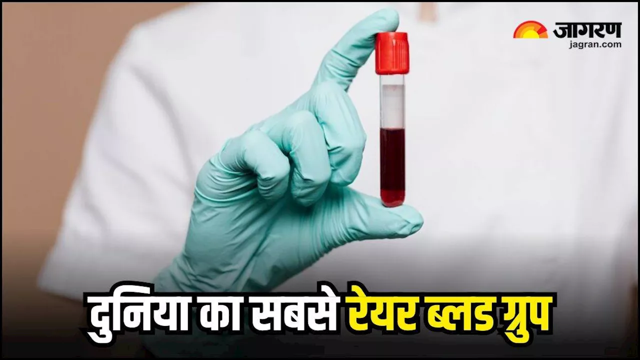 Rarest Blood Group: क्या होता है गोल्डन ब्लड ग्रुप और खास होते हुए भी कैसे बन सकता है परेशानी का सबब