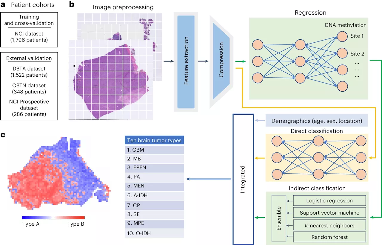 Research team develops new AI tool to help classify brain tumors