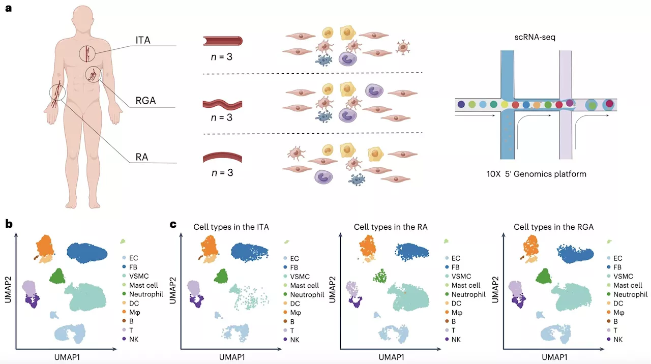 Researchers reveal molecular mechanisms of different donor arteries for coronary artery bypass grafting